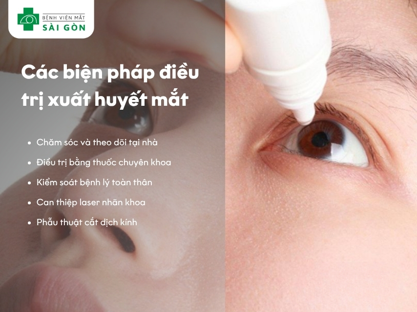 Các biện pháp giúp điều trị xuất huyết mắt